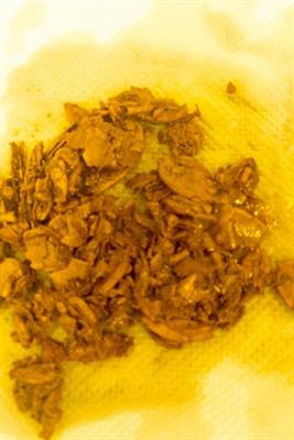 Harry Potter's Occlusion: Report of a Case of Pumpkin Seed Bezoar Rectal Impact